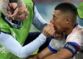 Kylian Mbappé due for tests on his broken nose as France gets ‘positive’ news on top star