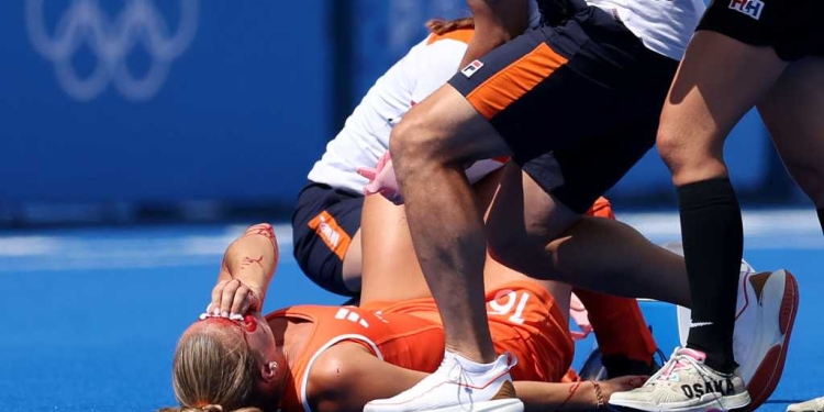 Blood, sweat and no tears – Joosje Burg and the example of the world’s best hockey team